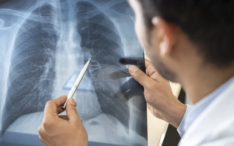 Male-doctor-pointing-at-lung-xray-with-pen-GettyImages-1208369994_Fotor-16x9-1